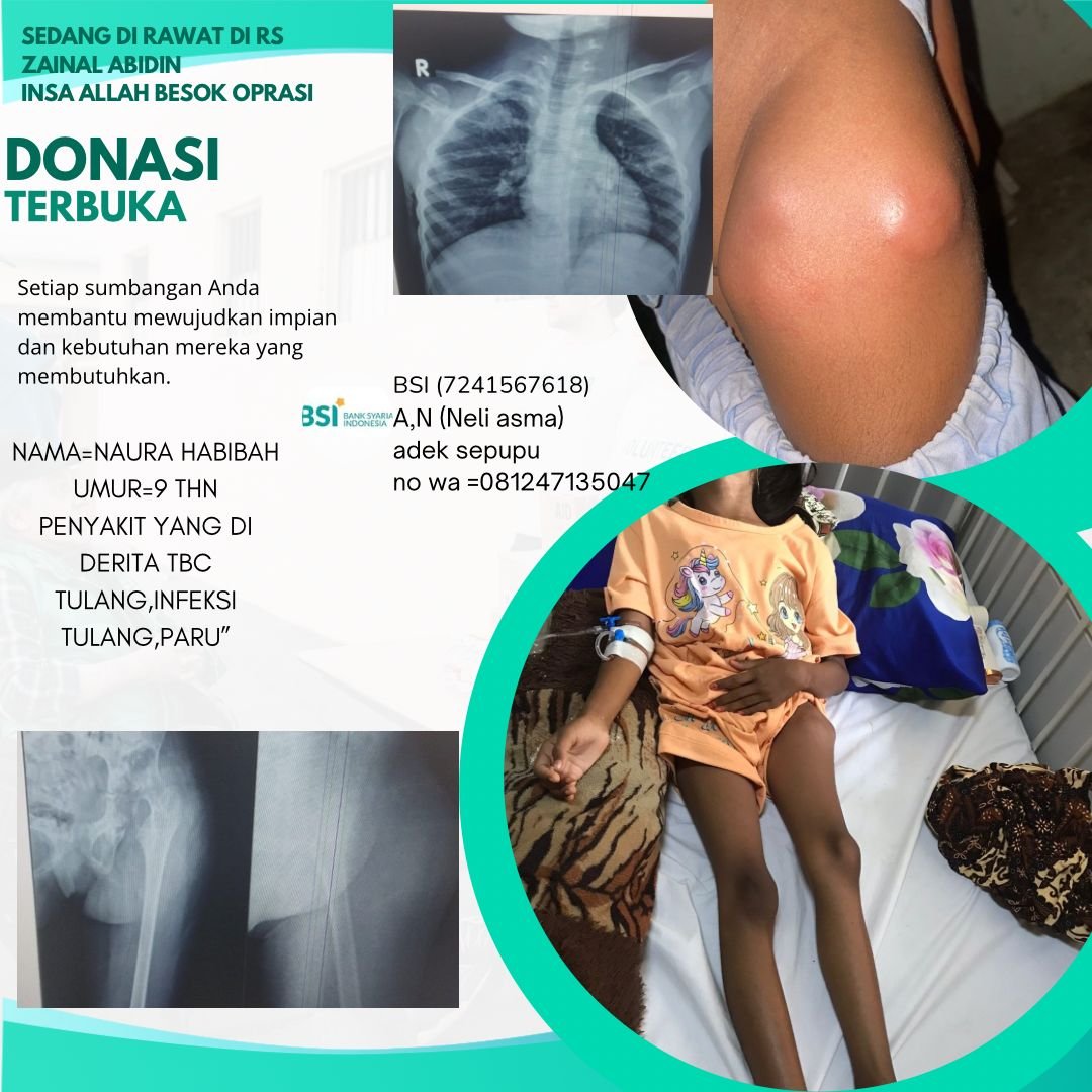Naura Habibah Butuh Uluran Tangan Kita Bersama